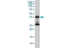 DNAJB6 antibody  (AA 1-241)