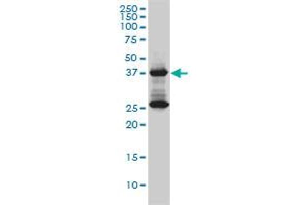 DNAJB6 antibody  (AA 1-241)