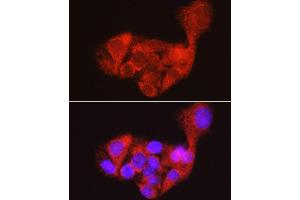 Immunofluorescence analysis of HepG2 cells using AGL antibody (ABIN7265574) at dilution of 1:100. (AGL antibody)