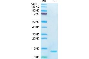 DDT Protein (AA 2-118) (His tag)