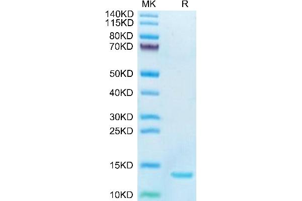 DDT Protein (AA 2-118) (His tag)