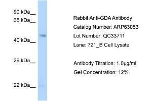 Western Blotting (WB) image for anti-Guanine Deaminase (GDA) (N-Term) antibody (ABIN2774360) (GDA antibody  (N-Term))