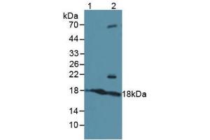 Western blot analysis of (1) Human Serum and (2) Human 293T Cells. (ATF3 antibody  (AA 1-181))