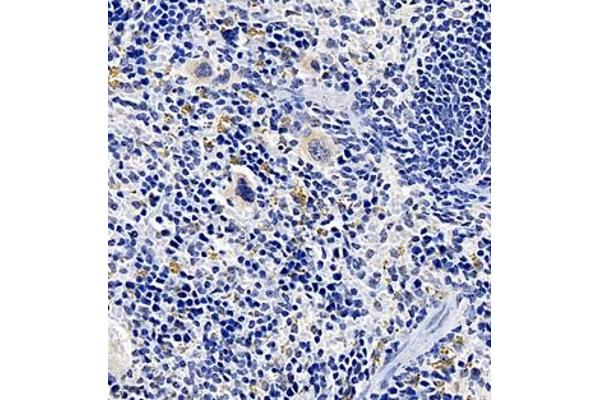 TREML1 antibody