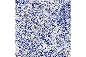 Immunohistochemistry of paraffin embedded mouse spleen using TREML1 (ABIN7076009) at dilution of 1:2200 (400x lens) (TREML1 antibody)