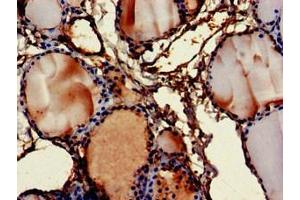 Immunohistochemistry of paraffin-embedded human thyroid tissue using ABIN7152871 at dilution of 1:100 (Fibromodulin antibody  (AA 18-89))