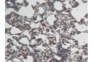 Detection of IL6 in Rat Lung Tissue using Monoclonal Antibody to Interleukin 6 (IL6) (IL-6 antibody  (AA 25-211))