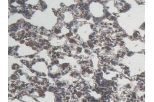 Detection of IL6 in Rat Lung Tissue using Monoclonal Antibody to Interleukin 6 (IL6) (IL-6 antibody  (AA 25-211))