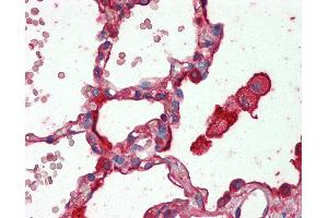 Anti-SFTPA1 / Surfactant Protein A antibody IHC staining of human lung. (Surfactant Protein A1 antibody)
