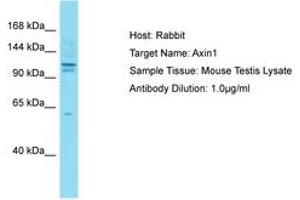 Image no. 1 for anti-Axin 1 (AXIN1) (AA 8-62) antibody (ABIN6750309) (Axin antibody  (AA 8-62))