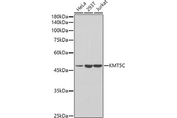 SUV420H2/KMT5C anticorps  (AA 100-200)