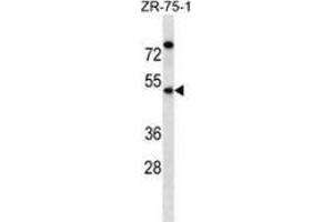 Western blot analysis in ZR-75-1 cell line lysates (35ug/lane) using EME2 Antibody (C-term). (EME2 antibody  (C-Term))