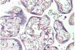 Human Placenta: Formalin-Fixed, Paraffin-Embedded (FFPE) (PSG3 antibody  (AA 22-50))