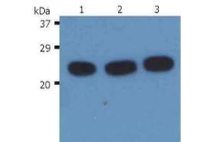Western Blotting (WB) image for anti-HRas proto-oncogene, GTPase (HRAS) antibody (ABIN238418) (HRAS antibody)