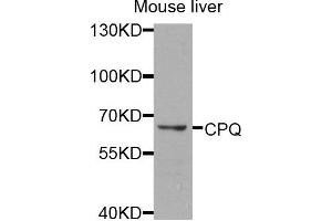 Western blot analysis of extracts of mouse liver cells, using CPQ antibody. (CPQ antibody)