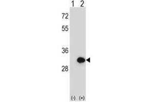 Western blot analysis of BPGM (arrow) using rabbit polyclonal BPGM Antibody (C-term) . (BPGM antibody  (C-Term))