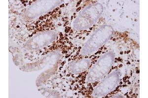 IHC-P Image PACAP antibody [N1C3] detects PACAP protein at cytosol on human normal colon mucosa with lymphocyte by immunohistochemical analysis. (MZB1 antibody)