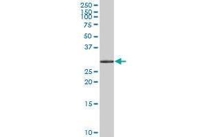 HSD17B6 MaxPab polyclonal antibody. (HSD17B6 antibody  (AA 1-317))