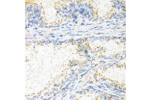 Immunohistochemistry of paraffin-embedded human prostate using NTF4 antibody at dilution of 1:100 (40x lens).