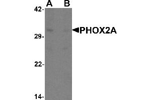 Western blot analysis of PHOX2A in rat brain tissue lysate with PHOX2A antibody at 1 µg/mL in (A) the absence and (B) the presence of blocking peptide.