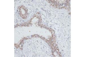 Immunohistochemistry of paraffin-embedded human breast using NOL3 antibody. (NOL3 antibody  (AA 1-208))