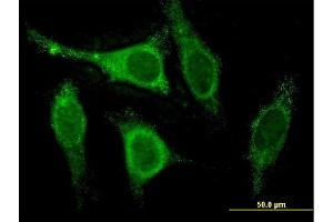 Immunofluorescence of monoclonal antibody to CSEN on HeLa cell. (DREAM antibody  (AA 1-256))