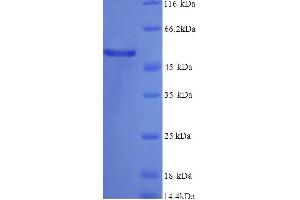 SDS-PAGE (SDS) image for Vitamin D-Binding Protein (GC) (AA 19-474) protein (His tag) (ABIN5713464)