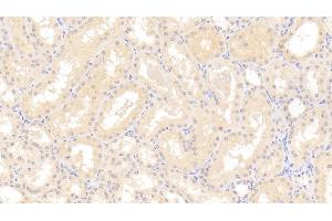 Detection of MR in Human Kidney Tissue using Polyclonal Antibody to Mineralocorticoid Receptor (MR) (NR3C2 antibody  (AA 739-984))