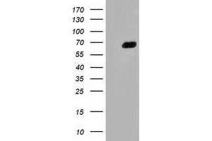 HEK293T cells were transfected with the pCMV6-ENTRY control (Left lane) or pCMV6-ENTRY AFP (Right lane) cDNA for 48 hrs and lysed. (alpha Fetoprotein antibody)