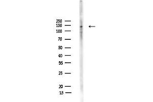 anti-rho GTPase Activating Protein 29 (ARHGAP29) antibody