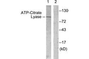 Western blot analysis of extracts from COS7 cells, treated with Calyculin 50nM 30', using ATP-Citrate Lyase (Ab-454) Antibody. (ACLY antibody  (AA 420-469))