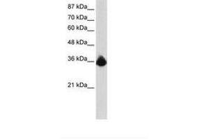 Image no. 1 for anti-Polypyrimidine Tract Binding Protein 2 (PTBP2) (N-Term) antibody (ABIN203072) (PTBP2 antibody  (N-Term))