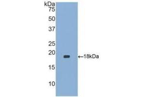 Detection of Recombinant HBEGF, Human using Polyclonal Antibody to Heparin Binding Epidermal Growth Factor Like Growth Factor (HBEGF) (HBEGF antibody  (AA 21-160))