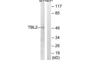 Western blot analysis of extracts from MCF-7 cells, using TBL2 antibody. (TBL2 antibody  (C-Term))
