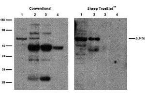 Western Blotting (WB) image for Sheep TrueBlot® Anti-Sheep IgG HRP  (ABIN1589972)