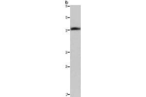 Gel: 6 % SDS-PAGE, Lysate: 40 μg, Lane: Human fetal liver tissue, Primary antibody: ABIN7129455(FAR2 Antibody) at dilution 1/1000, Secondary antibody: Goat anti rabbit IgG at 1/8000 dilution, Exposure time: 40 seconds (FAR2 antibody)