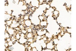 ABIN7094756 and ABIN7098807 at 1/100 staining Mouse lung tissue by IHC-P. (MED16 antibody  (Internal Region))