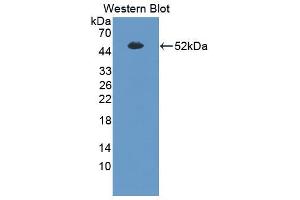 Western blot analysis of the recombinant protein. (SFTPB antibody  (AA 201-381))