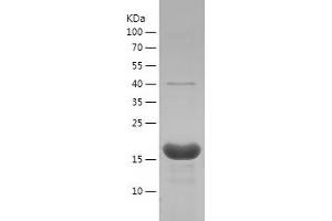 Western Blotting (WB) image for Peptidylprolyl Cis/trans Isomerase, NIMA-Interacting 1 (PIN1) (AA 1-163) protein (His tag) (ABIN7283192) (PIN1 Protein (AA 1-163) (His tag))