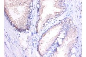 Immunohistochemistry of paraffin-embedded human spleen tissue using ABIN7156957 at dilution of 1:100 (MMP1 antibody  (AA 101-469))