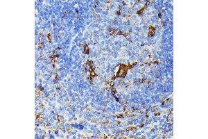 Immunohistochemistry of paraffin-embedded mouse spleen using TI antibody (ABIN6133213, ABIN6149144, ABIN6149145 and ABIN6221696) at dilution of 1:100 (40x lens). (TIAL1 antibody  (AA 266-375))