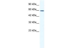 WB Suggested Anti-DDX5 Antibody Titration:  1. (DDX5 antibody  (C-Term))