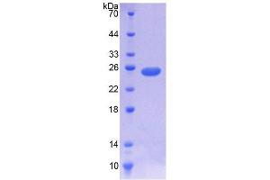 SDS-PAGE (SDS) image for NODAL Modulator 1 (NOMO1) (AA 365-542) protein (His tag) (ABIN4990889)