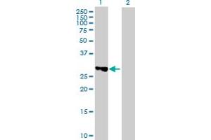 TBC1D7 antibody  (AA 1-293)