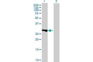 Western Blot analysis of TBC1D7 expression in transfected 293T cell line by TBC1D7 MaxPab polyclonal antibody.