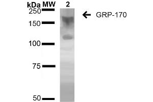 Western Blot analysis of Human Embryonic kidney epithelial cell line (HEK293) lysates showing detection of ~170 kDa GRP170 protein using Mouse Anti-GRP170 Monoclonal Antibody, Clone 6E3-2C2 (ABIN2868640). (HYOU1 antibody  (FITC))