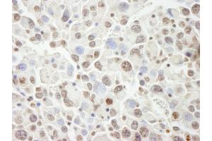 Immunohistochemistry (IHC) image for anti-PHD Finger Protein 6 (PHF6) (AA 125-175) antibody (ABIN7448999) (PHF6 antibody  (AA 125-175))
