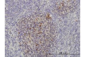 Immunoperoxidase of monoclonal antibody to PIK3CB on formalin-fixed paraffin-embedded human lymph node. (PIK3CB antibody  (AA 147-256))