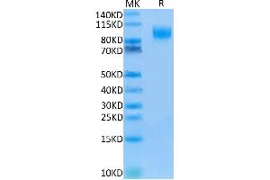Human IL-13Ra1 on Tris-Bis PAGE under reduced conditions. (IL13 Receptor alpha 1 Protein (AA 27-343) (Fc Tag))