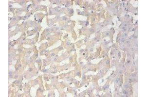 Immunohistochemical of paraffin-embedded human liver tissue using ABIN7165035 at dilution of 1:200 (AMBP antibody)
